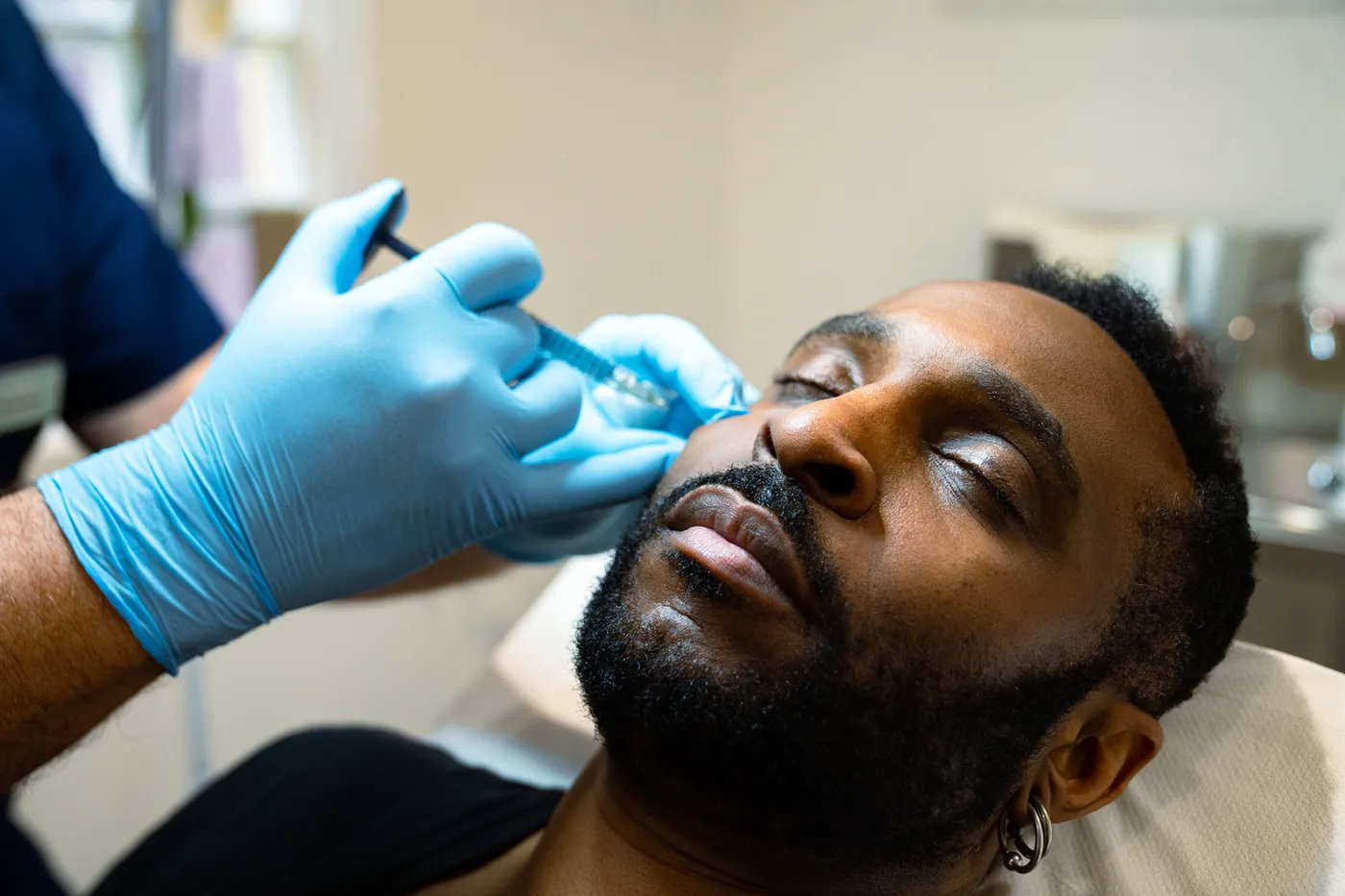 Dermal Filler SE1 Medical Aesthetics