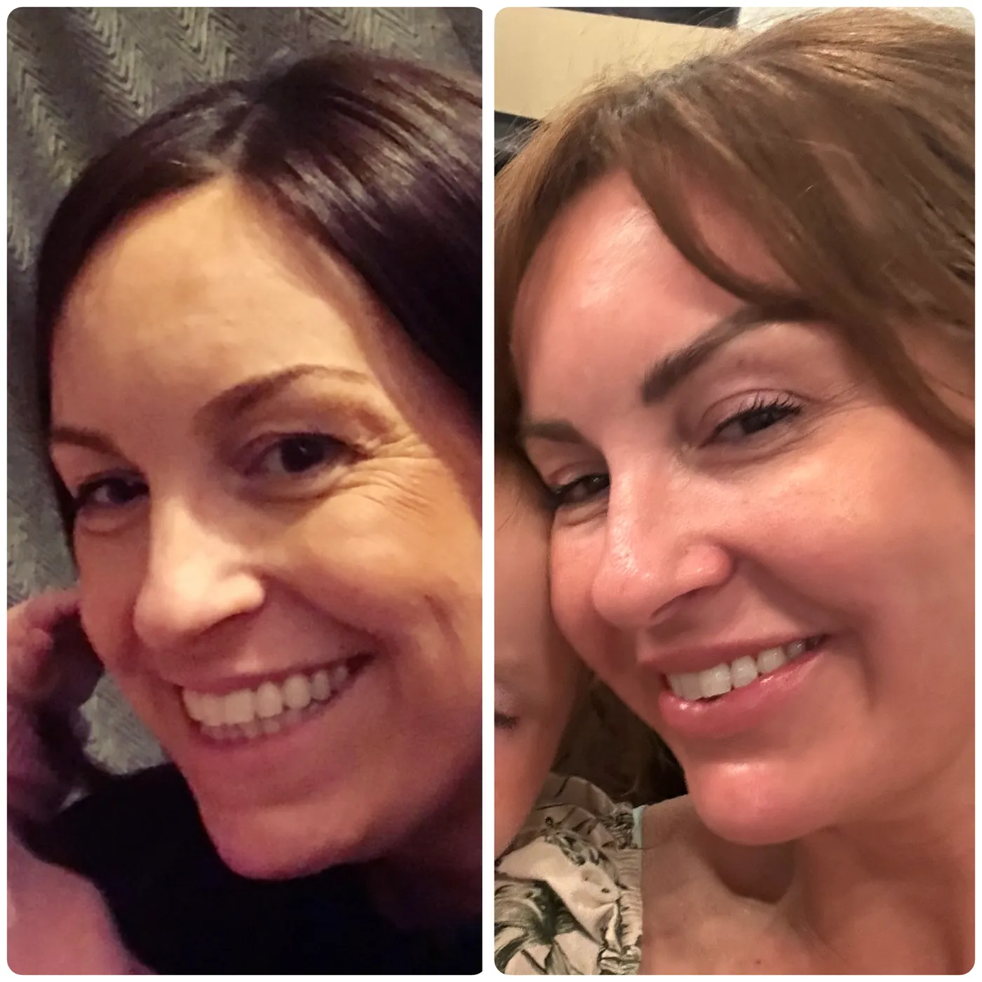 £2,000 Skincare Giveaway News...