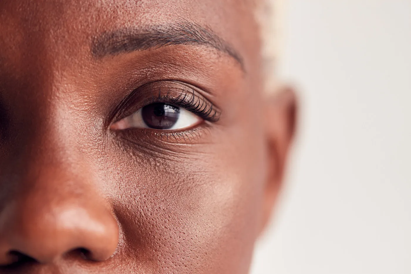 Exclusive Case Study Offer: Dr Lorenzo Half Price Under Eye Polynucleotides