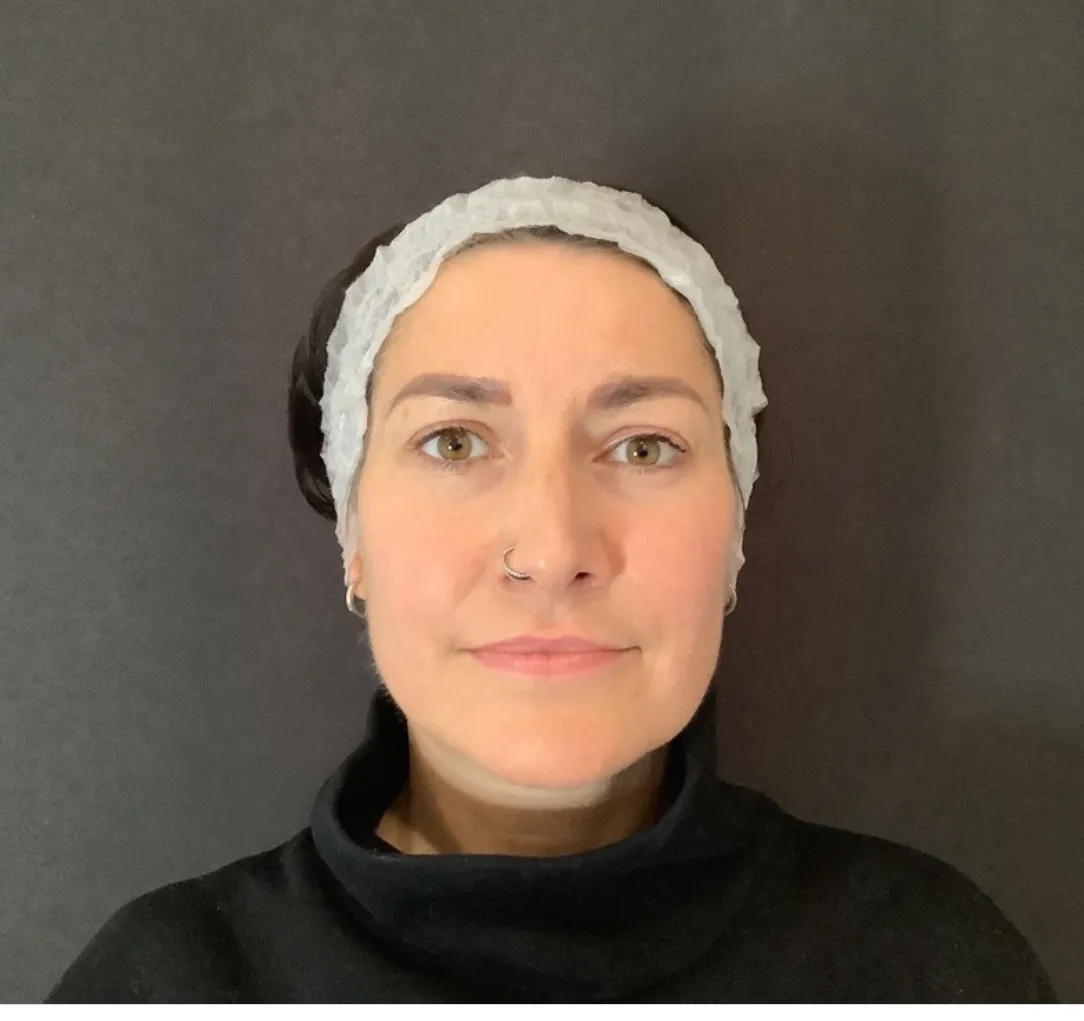 Facial Rejuvenation at SE1 Medical Aesthetics London