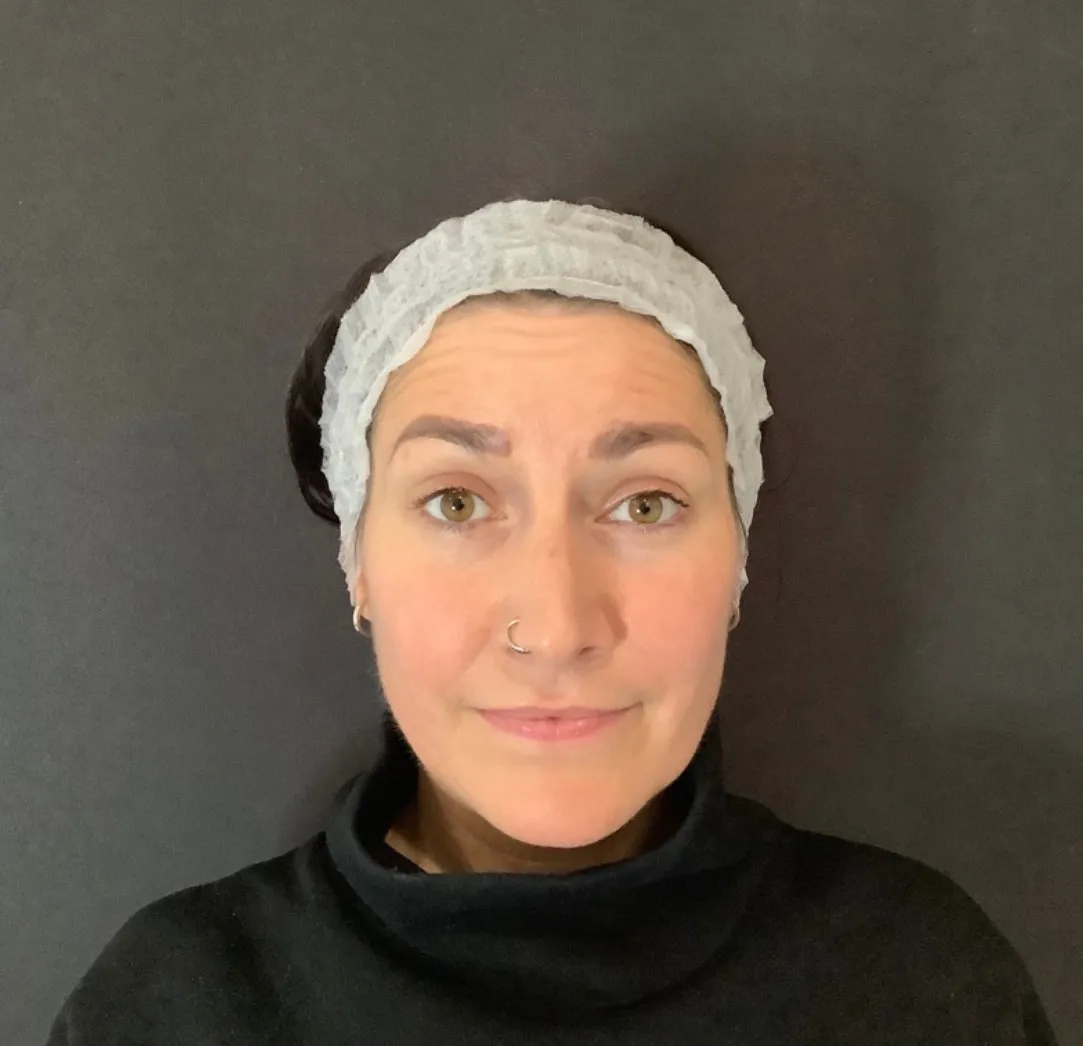 Facial Rejuvenation at SE1 Medical Aesthetics London