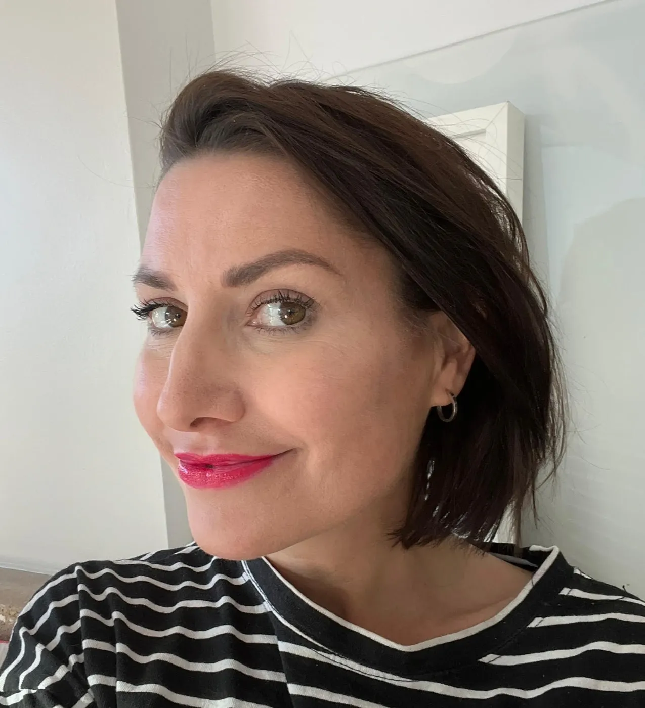 Facial Rejuvenation at SE1 Medical Aesthetics London