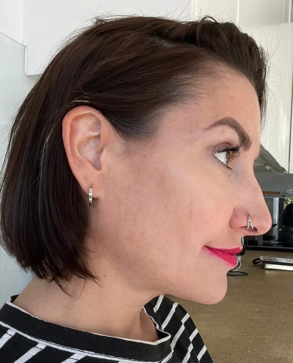 Facial Rejuvenation at SE1 Medical Aesthetics London