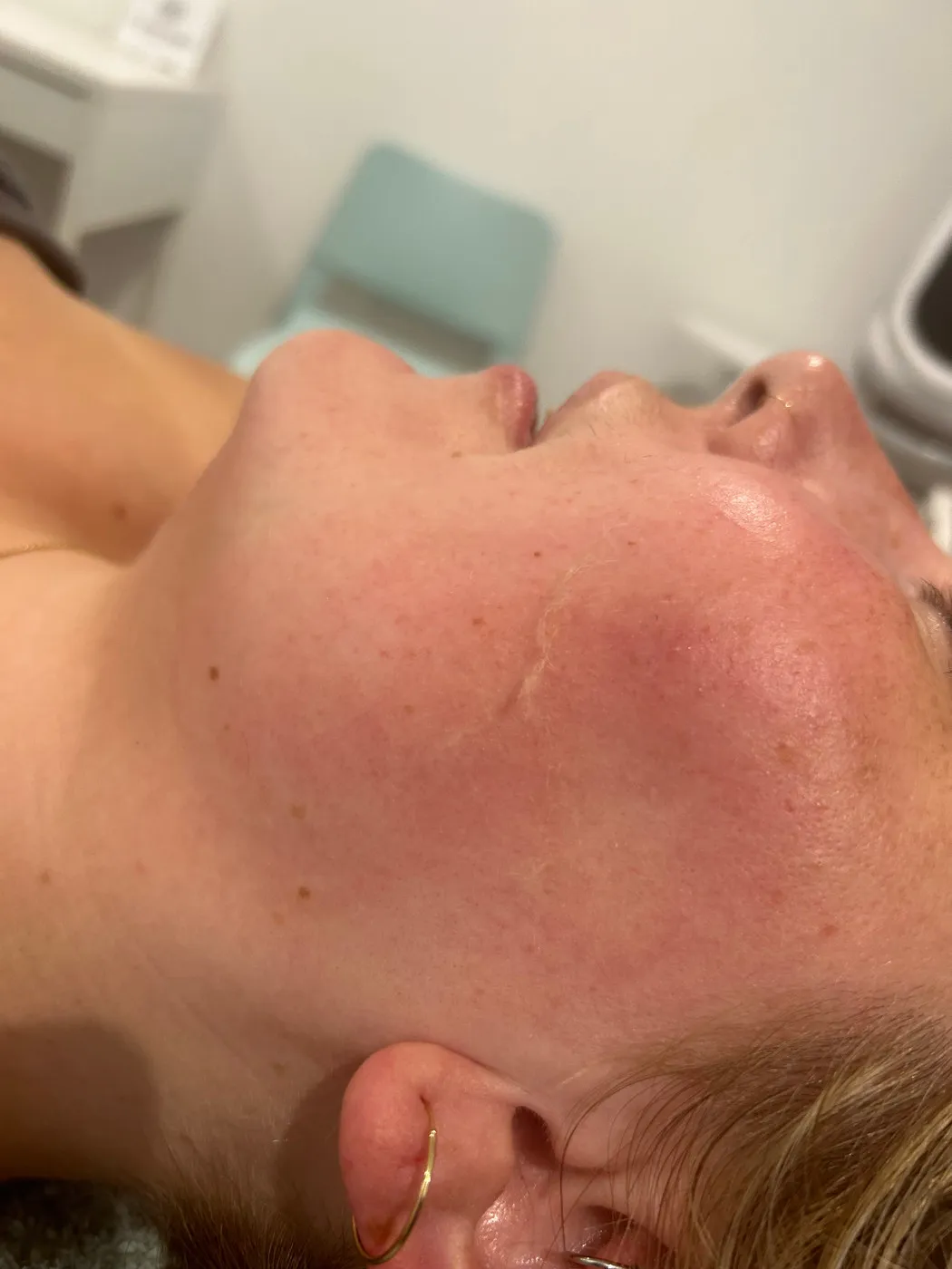 Latest news & September offers & Dermaplaning!