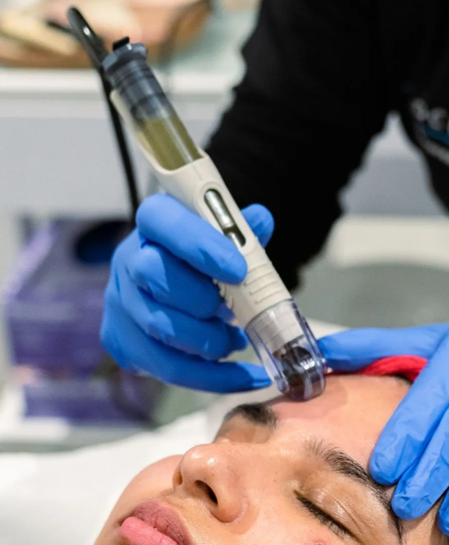 What is DermaFrac® Microneedling?
