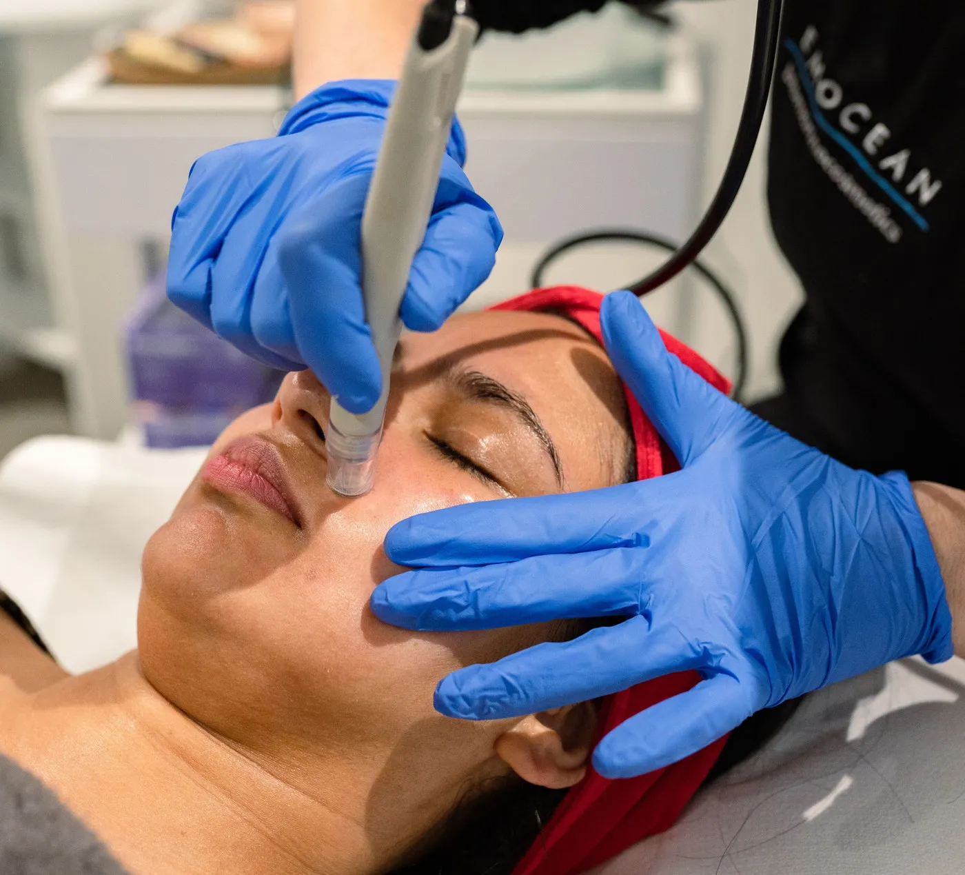 Patient having microdermabrasion at SE1 Medical Aesthetics London