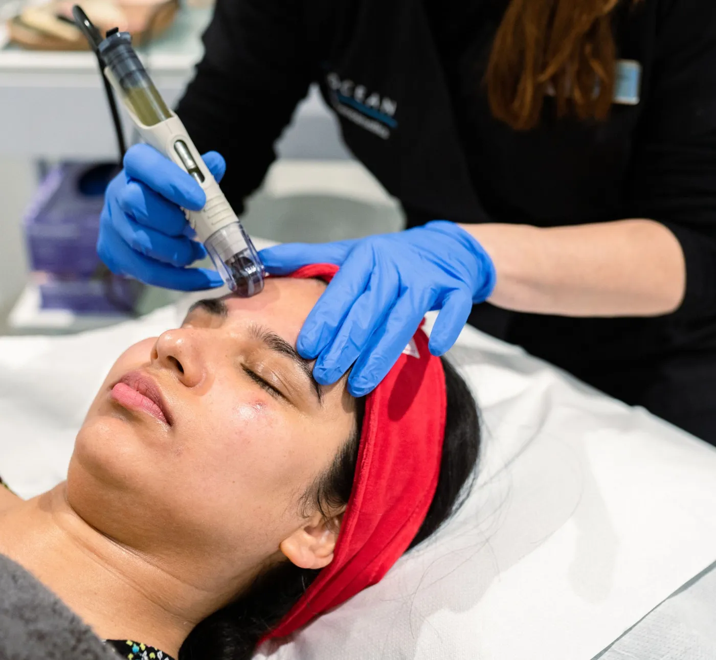 Patient having microneedling at SE1 Medical Aesthetics London