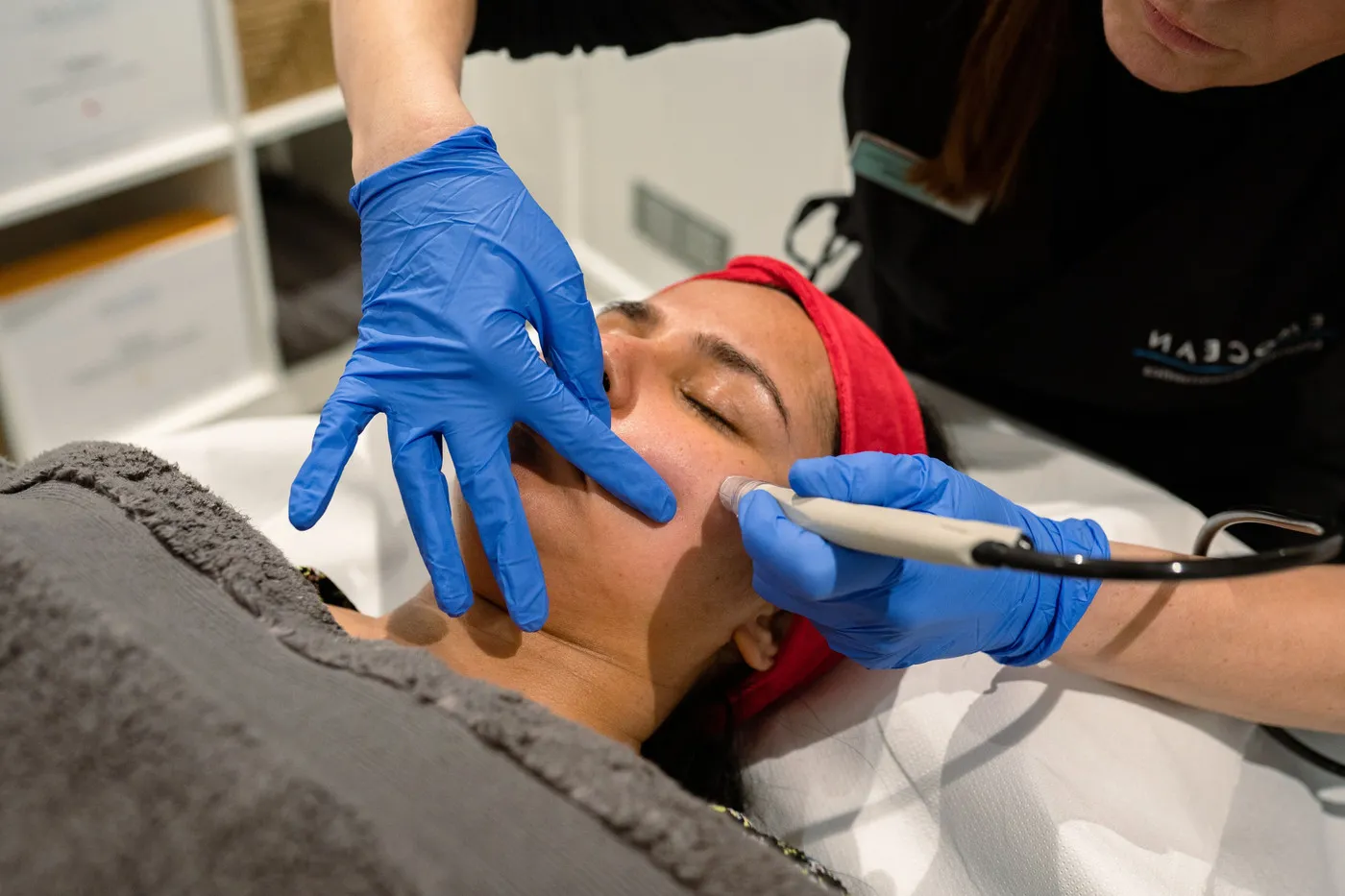 DermaFrac Microneedling