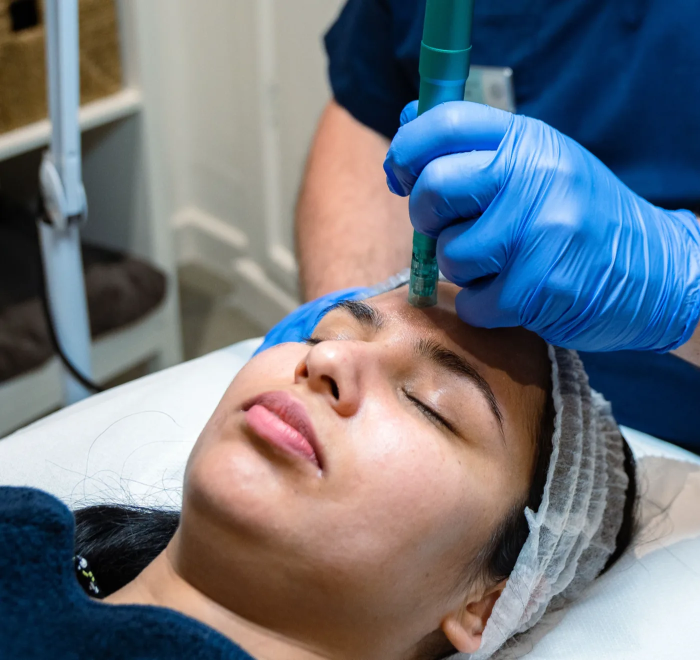 Microneedling treatment with a practitioner