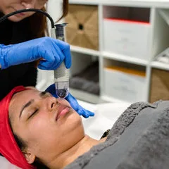 DermaFrac Microneedling (x6)