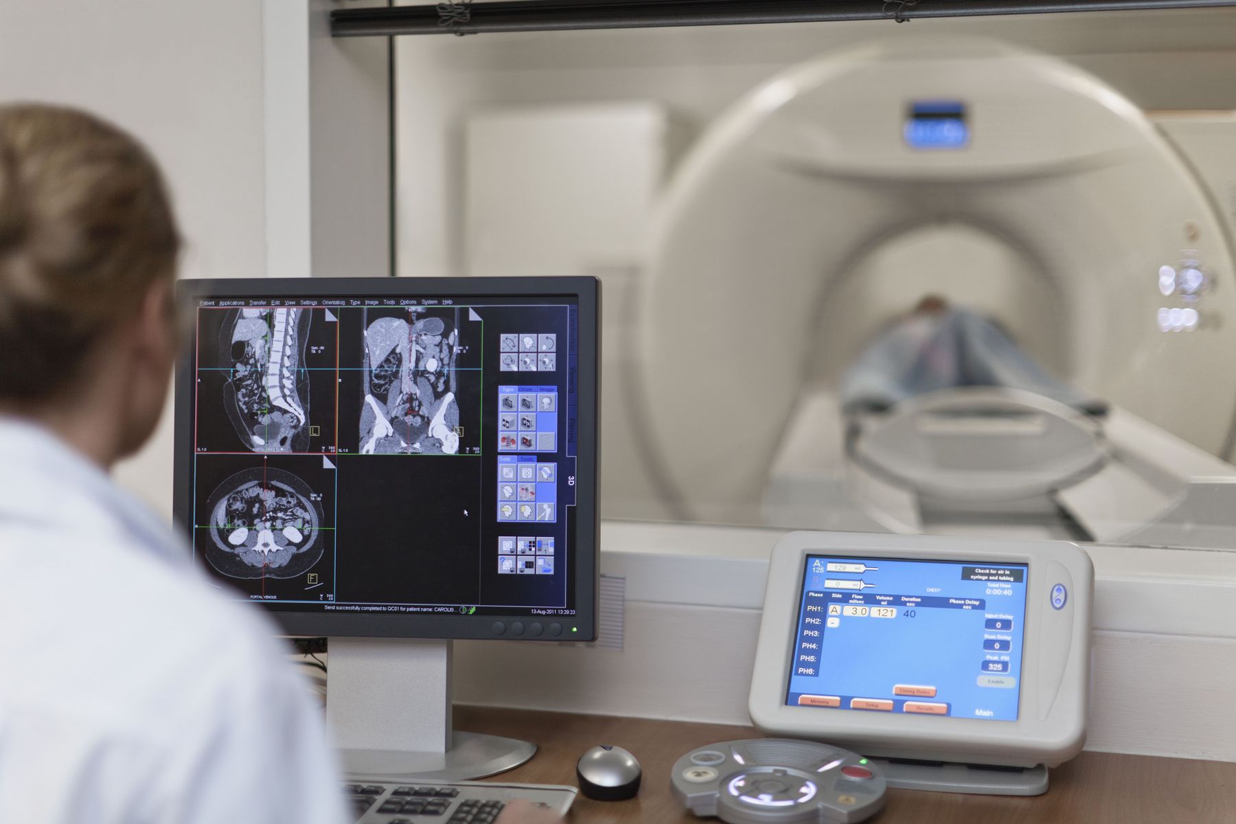 Scans - MRI, US, XR, CT