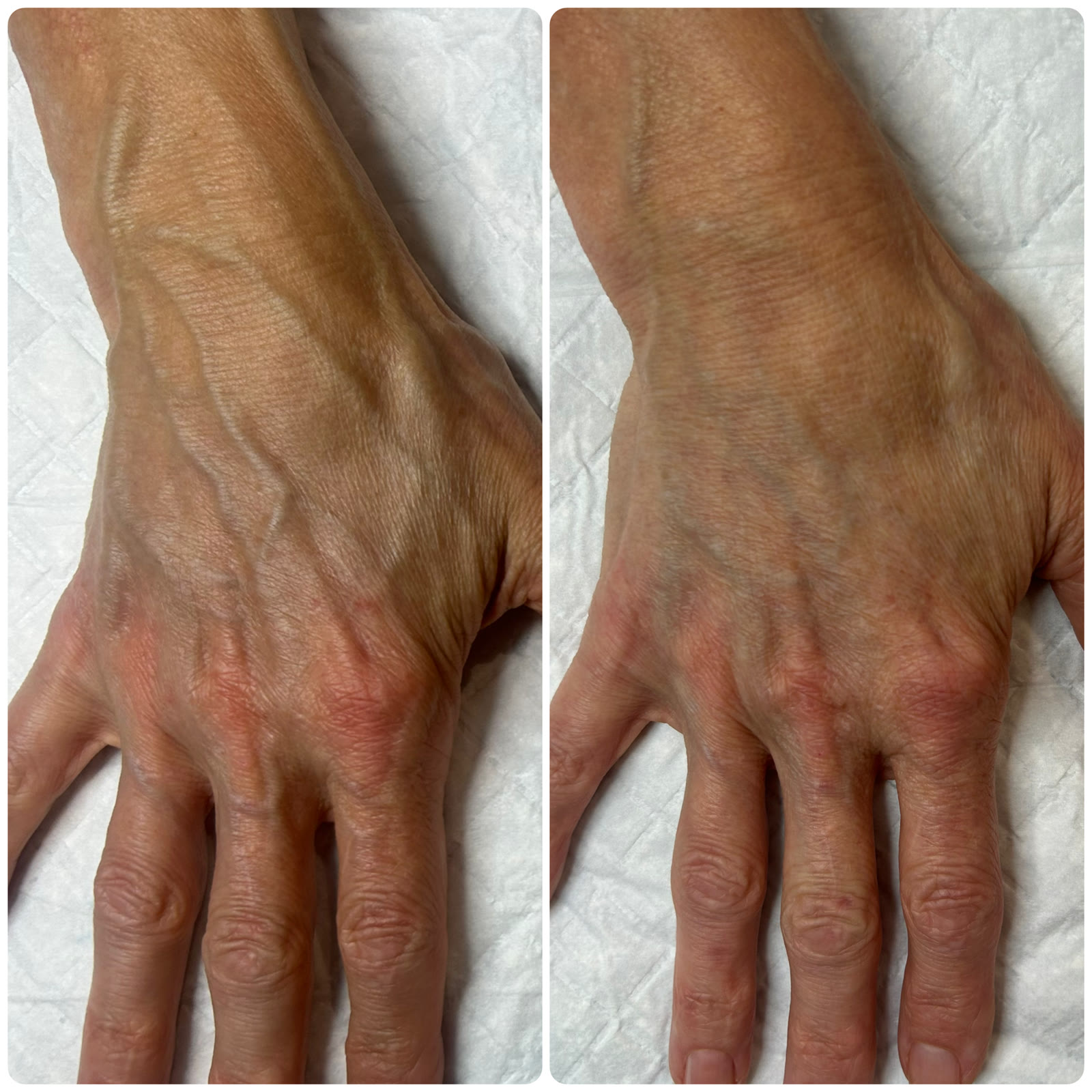 Alice Hart-Davis before and after