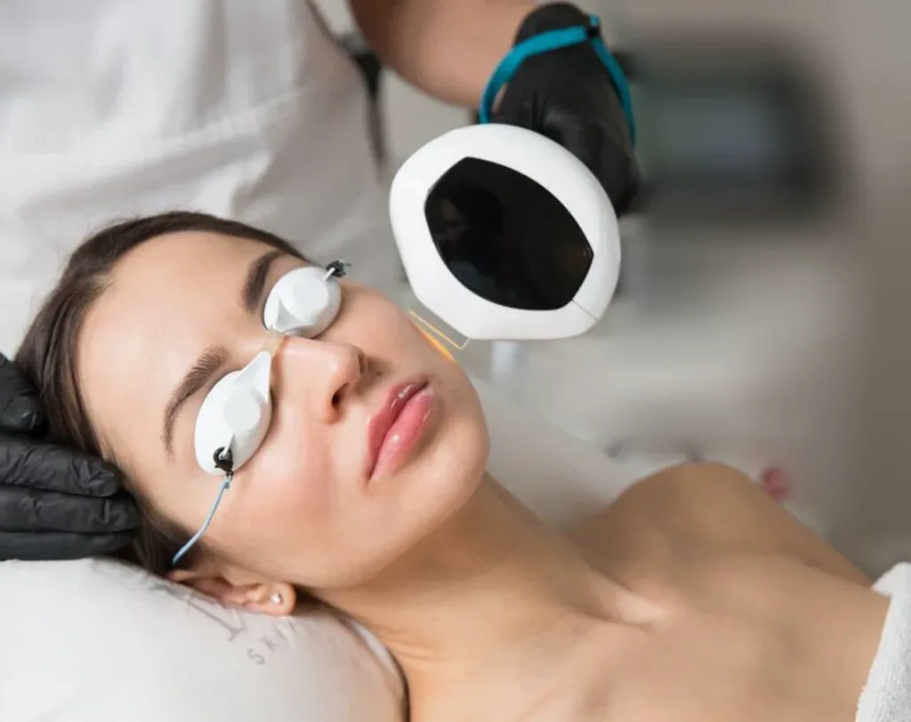 Lumecca IPL® treatment